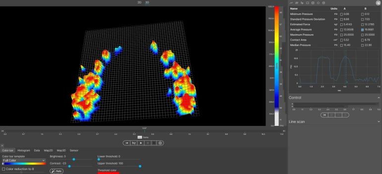 Dental Occlusion pressure system